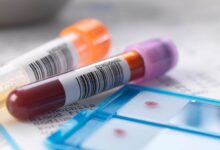 Kan Testleri (Endokrin Hastalıklarının Araştırılması)