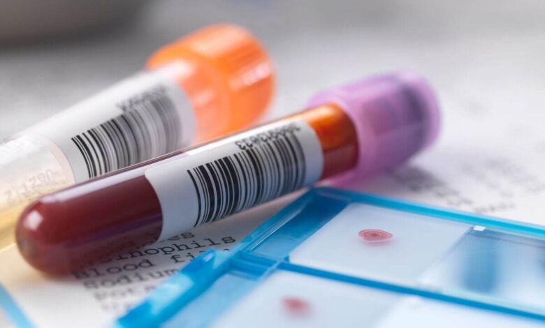 Kan Testleri (Endokrin Hastalıklarının Araştırılması)